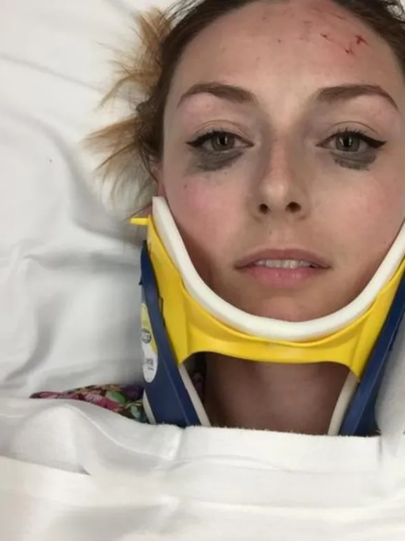 Una chica descubre el delineador perfecto tras sufrir un accidente