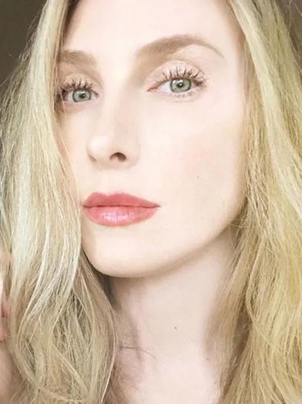Taylor Muhl, la modelo que tiene el vientre de dos colores
