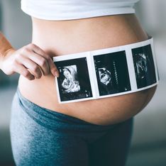 La pollution crée des tâches noires sur le placenta des femmes enceintes