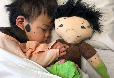 Cette maman crée des poupées personnalisées pour les enfants porteurs d'un handicap