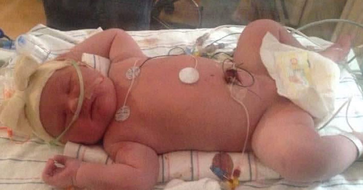 Cette Maman Accouche D Un Bebe De Presque 7 Kg
