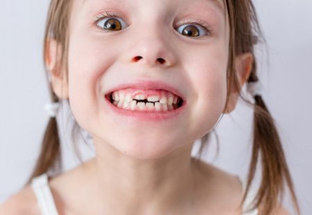 D'après une étude, garder les dents de lait de votre enfant pourrait lui sauver la vie plus tard