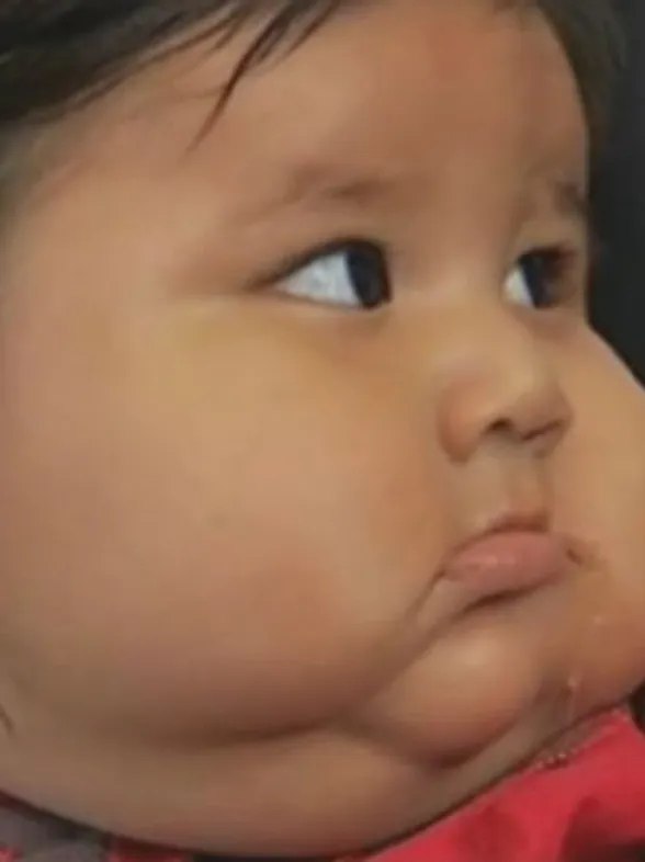 Acht maanden oud en twintig kilo&hellip; ofwel drie keer meer dan normaal!