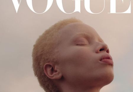Bravo ! Pour la première fois, Vogue célèbre la différence avec une covergirl albinos