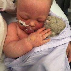 Elle publie les photos choquantes de son bébé pour alerter sur la non-vaccination