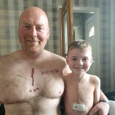 Ce papa se fait tatouer la même cicatrice que son petit garçon opéré du coeur