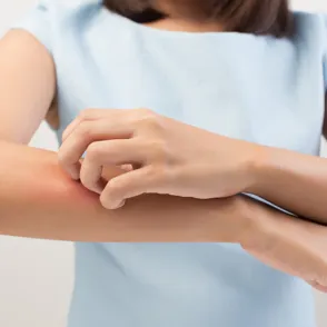 Sabemos por qué eres más propensa a que te piquen los mosquitos