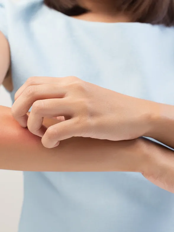 Sabemos por qué eres más propensa a que te piquen los mosquitos