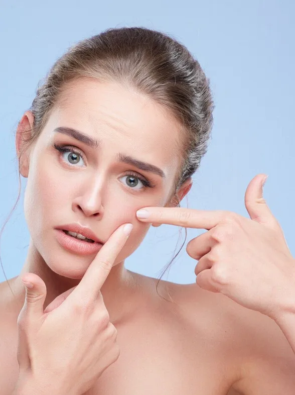 ¿Un grano en el peor momento? Hazlo desaparecer con estas cremas y di adiós al acné