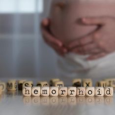 Hemorroides en el embarazo: causas comunes y cómo prevenirlas