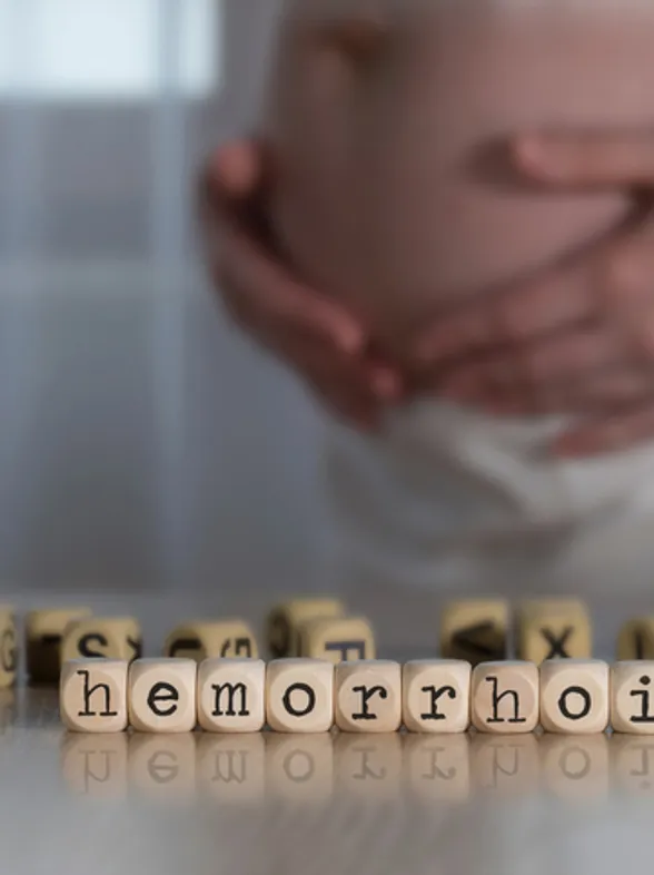 Hemorroides en el embarazo: causas comunes y cómo prevenirlas