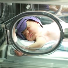 Ittero neonatale: cos'è, quali sono le cause e trattamento consigliato