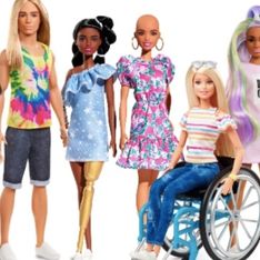 Poupées chauves, atteintes de vitiligo… Barbie® fait la part belle à la diversité avec sa nouvelle gamme