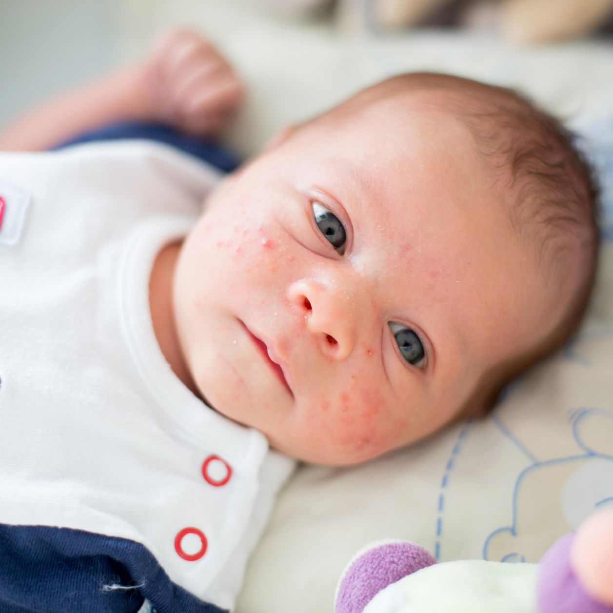 La roséole du bébé : que faire contre cette maladie infantile ?