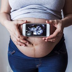 Camera gestazionale: dove avviene lo sviluppo dell'embrione durante la gravidanza