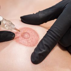 Cancer du sein : la 3D-pigmentation des aréoles offerte dans les instituts MAUD