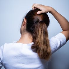 Cuoio capelluto irritato: rimedi per bruciore e prurito