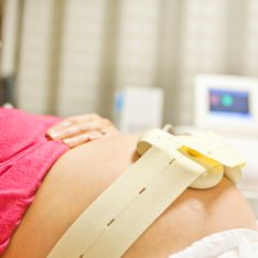 Tutto quello che devi sapere sul tracciato in gravidanza