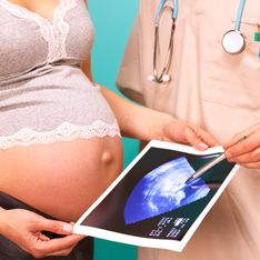Flussimetria materno fetale: tutto quello che c'è da sapere sul Doppler in gravidanza