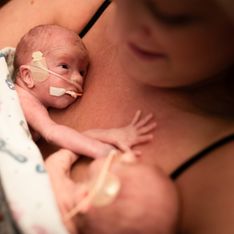 Prématurité : et si le peau à peau pouvait sauver la vie d’un bébé ?