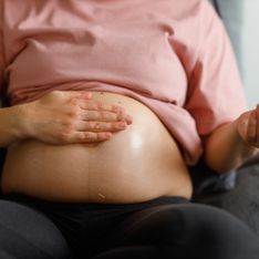 Huile anti vergeture : Top 7 des produits pour atténuer les vergetures de grossesse