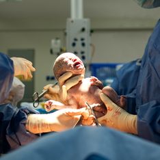 VIDÉO - Un bébé encore dans sa poche de liquide amniotique !