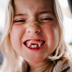 Quand les dents de lait de mon enfant vont-elles tomber ?