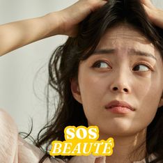 SOS Beauté : mon cuir chevelu me démange à cause du stress, que faire ?