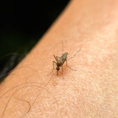 Rimedi naturali per punture di zanzare: come alleviare prurito e gonfiore