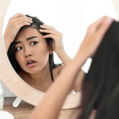 Geheimratsecken bei Frauen: SOS-Tipps bei Haarverlust
