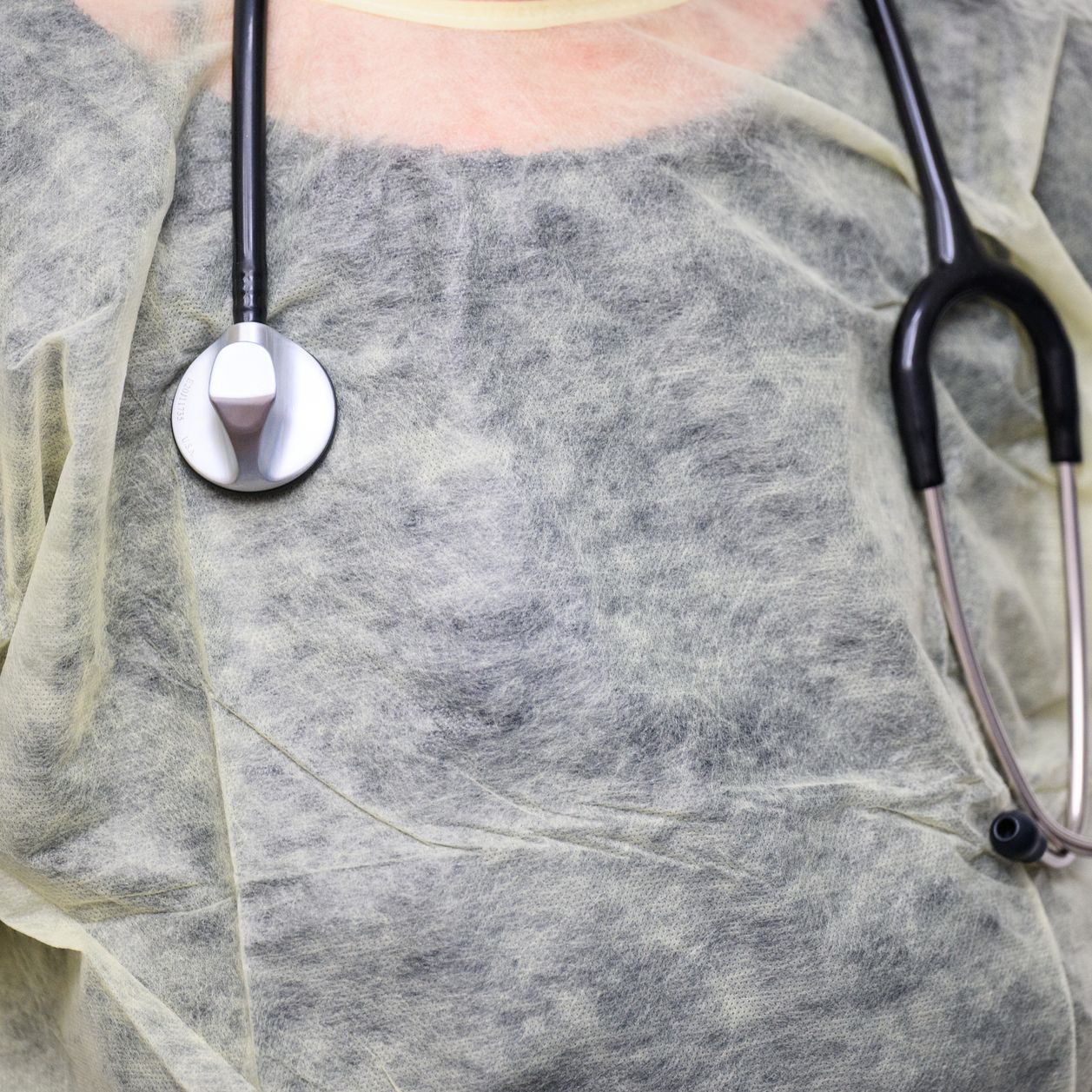 Cholestérol : attention à ces 5 signes qui peuvent être une alerte