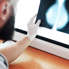 Mamografías con IA detectan el cáncer de mama un 20% más según un estudio