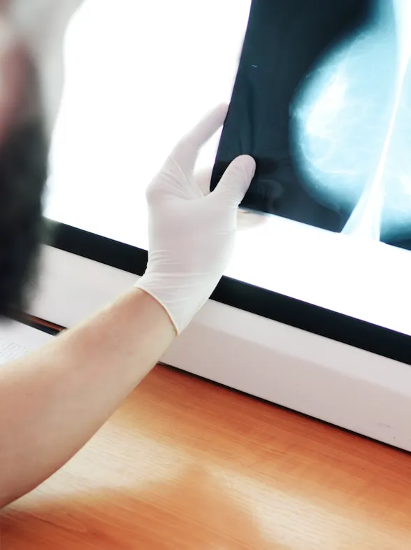 Mamografías con IA detectan el cáncer de mama un 20% más según un estudio