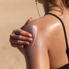 Cómo tratar y prevenir las quemaduras producidas por el sol en nuestra piel