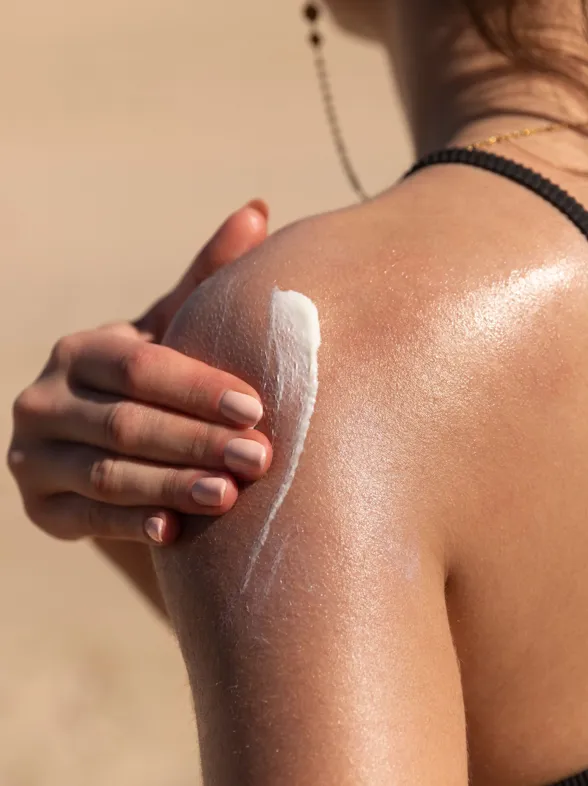 Cómo tratar y prevenir las quemaduras producidas por el sol en nuestra piel