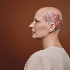 'Calvas: mujeres sin nada que ocultar', libro y exposición que desafían el estigma de la alopecia femenina
