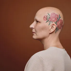 'Calvas: mujeres sin nada que ocultar', libro y exposición que desafían el estigma de la alopecia femenina