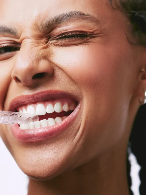 Ortodoncia invisible: La solución para una sonrisa saludable y estética