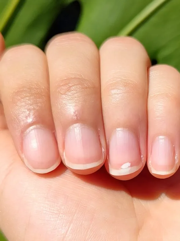 Manchas blancas en las uñas: ¿Mito del calcio o señal de alerta? ¡Farmacéutico te lo explica!