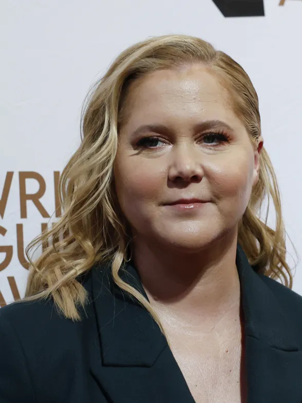 ¿Qué es el Síndrome de Cushing que padece la comediante Amy Schumer y que le ha hinchado la cara?