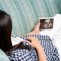 ¡Bebé de piedra! Fallece mujer tras 30 años con un feto calcificado en su vientre