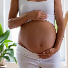 ¿Cómo cambia la piel durante el embarazo?
