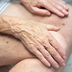 Cómo evitar las manchas de las manos a partir de los 60 años