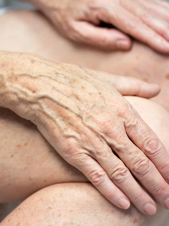 Cómo evitar las manchas de las manos a partir de los 60 años
