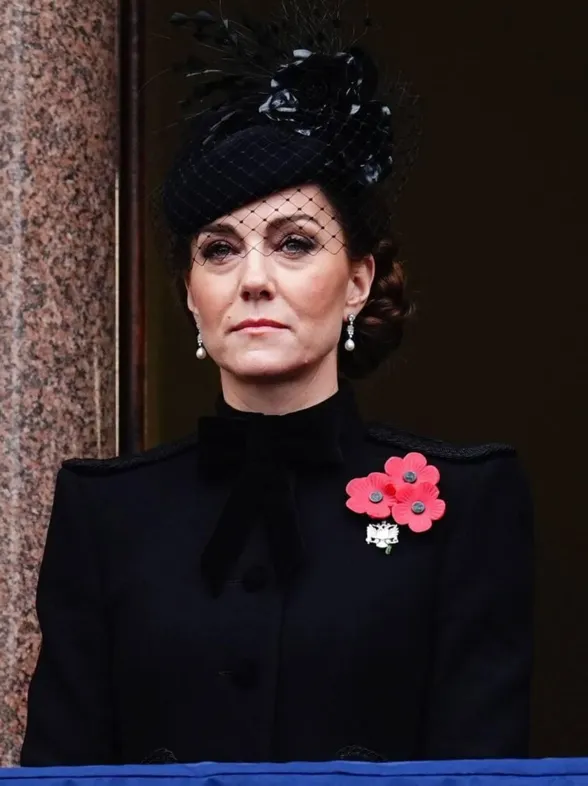 ¿Por qué Kate Middleton parece haber envejecido? Un experto analiza las razones detrás de su cambio de apariencia