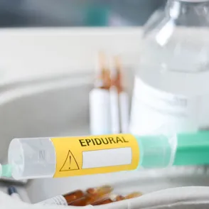Anestesia epidural: todo lo que debes saber