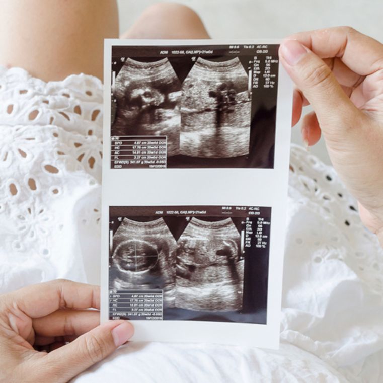 Come Capire Che La Gravidanza Procede Bene Al 4 Mese
