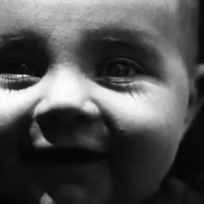 ¡OJO! Así es tu piel bajo la mirada del sol
