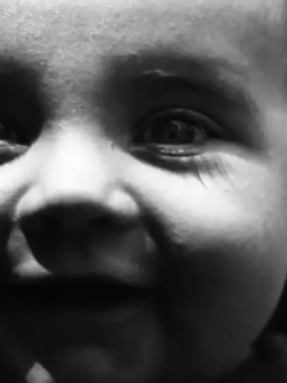 ¡OJO! Así es tu piel bajo la mirada del sol