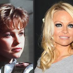 Pamela Anderson et la chirurgie esthétique : Son avant/après en photos